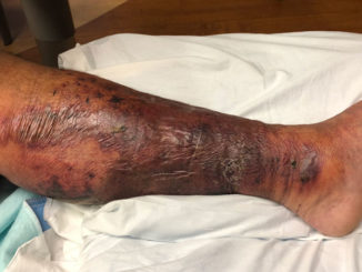 (Photo courtesy Ronald Latapie)